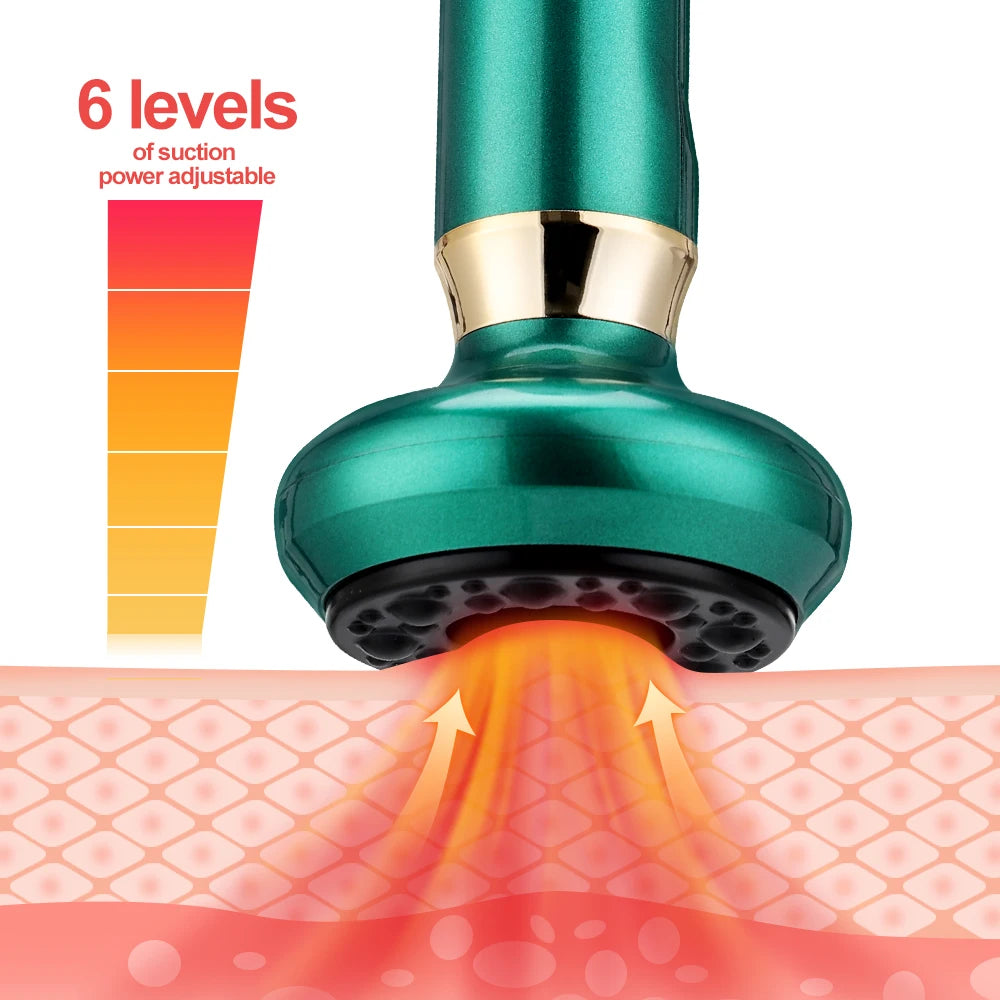 Intelligent Suction Medical Cupping