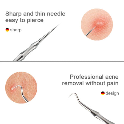 Acne Blackhead Removal Needles