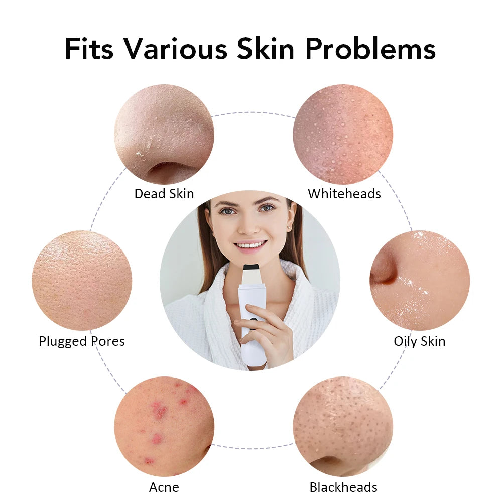 Ultrasonic Skin Scrubber Peeling Blackhead Remover