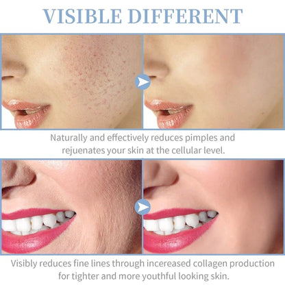 Portable High Frequency Facial Therapy Wand