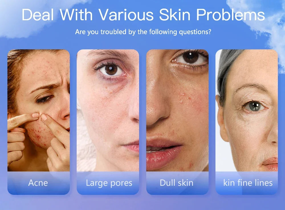 Portable Rechargeable Skin Analyzer